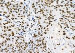 PRKAR1B Antibody in Immunohistochemistry (Paraffin) (IHC (P))