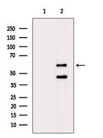 FRK Antibody in Western Blot (WB)