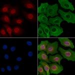 ETV1 Antibody in Immunocytochemistry (ICC/IF)