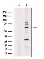 ETV1 Antibody in Western Blot (WB)