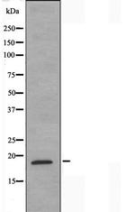 NCBP2 Antibody in Western Blot (WB)