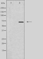 LIMK2 Antibody in Western Blot (WB)