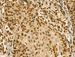 PITX1 Antibody in Immunohistochemistry (Paraffin) (IHC (P))