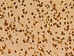 PITX1 Antibody in Immunohistochemistry (Paraffin) (IHC (P))