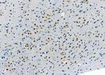 ADARB1 Antibody in Immunohistochemistry (Paraffin) (IHC (P))