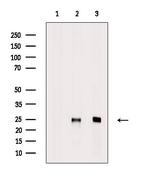 SRSF3 Antibody in Western Blot (WB)