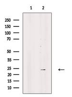 SRY Antibody in Western Blot (WB)