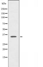 FOXL1 Antibody in Western Blot (WB)