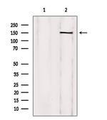 TCOF1 Antibody in Western Blot (WB)