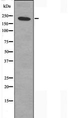 ZNF638 Antibody in Western Blot (WB)