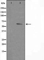 DOK7 Antibody in Western Blot (WB)