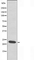 LDOC1L Antibody in Western Blot (WB)