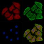 ADCK2 Antibody in Immunocytochemistry (ICC/IF)