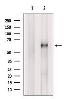 ACRBP Antibody in Western Blot (WB)