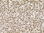 PPP1R14C Antibody in Immunohistochemistry (Paraffin) (IHC (P))