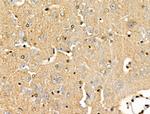 PPP1R14C Antibody in Immunohistochemistry (Paraffin) (IHC (P))