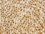 SMARCC2 Antibody in Immunohistochemistry (Paraffin) (IHC (P))