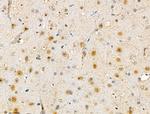 SMARCC2 Antibody in Immunohistochemistry (Paraffin) (IHC (P))