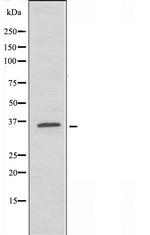 PMEPA1 Antibody in Western Blot (WB)