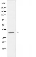 C1orf35 Antibody in Western Blot (WB)