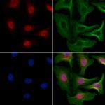 NY-BR-1 Antibody in Immunocytochemistry (ICC/IF)