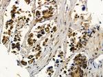 NY-BR-1 Antibody in Immunohistochemistry (Paraffin) (IHC (P))