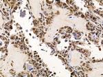 NY-BR-1 Antibody in Immunohistochemistry (Paraffin) (IHC (P))