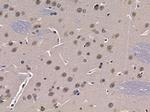 NY-BR-1 Antibody in Immunohistochemistry (Paraffin) (IHC (P))