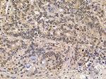 NY-BR-1 Antibody in Immunohistochemistry (Paraffin) (IHC (P))