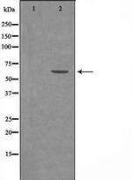 YTHDF1 Antibody in Western Blot (WB)