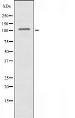 XRN2 Antibody in Western Blot (WB)