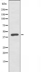 Lass4 Antibody in Western Blot (WB)