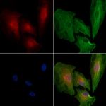 CD160 Antibody in Immunocytochemistry (ICC/IF)