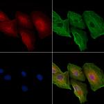 CDH16 Antibody in Immunocytochemistry (ICC/IF)