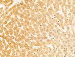 CYP27A1 Antibody in Immunohistochemistry (Paraffin) (IHC (P))