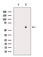 CYP2W1 Antibody in Western Blot (WB)