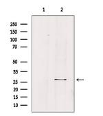 FGF23 Antibody in Western Blot (WB)