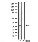 FGF23 Antibody in Western Blot (WB)