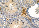 IL17RA Antibody in Immunohistochemistry (Paraffin) (IHC (P))