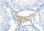 IL17RA Antibody in Immunohistochemistry (Paraffin) (IHC (P))