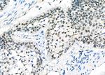 DATF1 Antibody in Immunohistochemistry (Paraffin) (IHC (P))