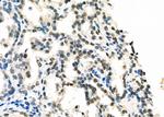 DATF1 Antibody in Immunohistochemistry (Paraffin) (IHC (P))