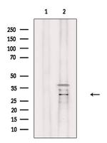 ABHD14A Antibody in Western Blot (WB)