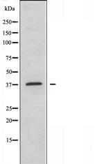 ABHD6 Antibody in Western Blot (WB)