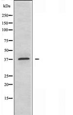 ABHD9 Antibody in Western Blot (WB)