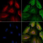 AARSD1 Antibody in Immunocytochemistry (ICC/IF)