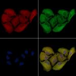 AKR1C2 Antibody in Immunocytochemistry (ICC/IF)