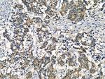 AKR1C2 Antibody in Immunohistochemistry (Paraffin) (IHC (P))