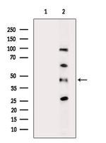 AKR1C2 Antibody in Western Blot (WB)