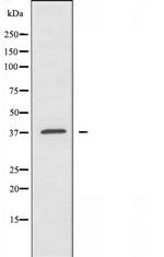 A4GNT Antibody in Western Blot (WB)